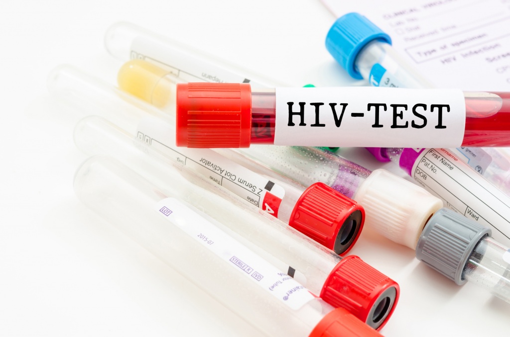 ВИЧ-тестирование