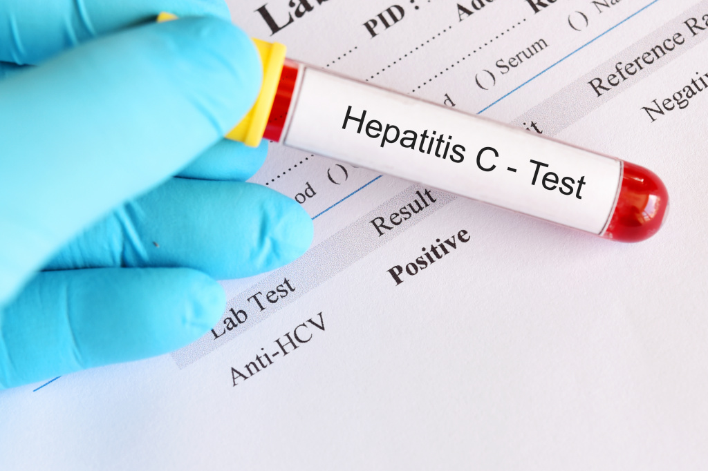 Выявление антител к гепатиту С: anti-HCV total, IgG, IgM, core, NS