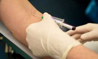 Тест: гепатит В и С — риск заражения