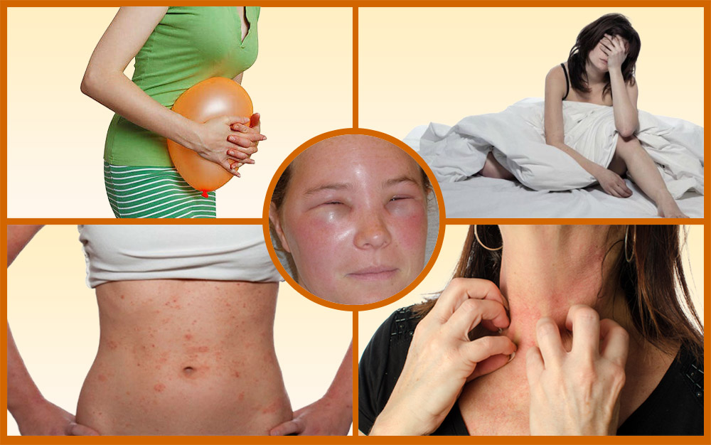 Первые симптомы гепатита С у женщин с фото