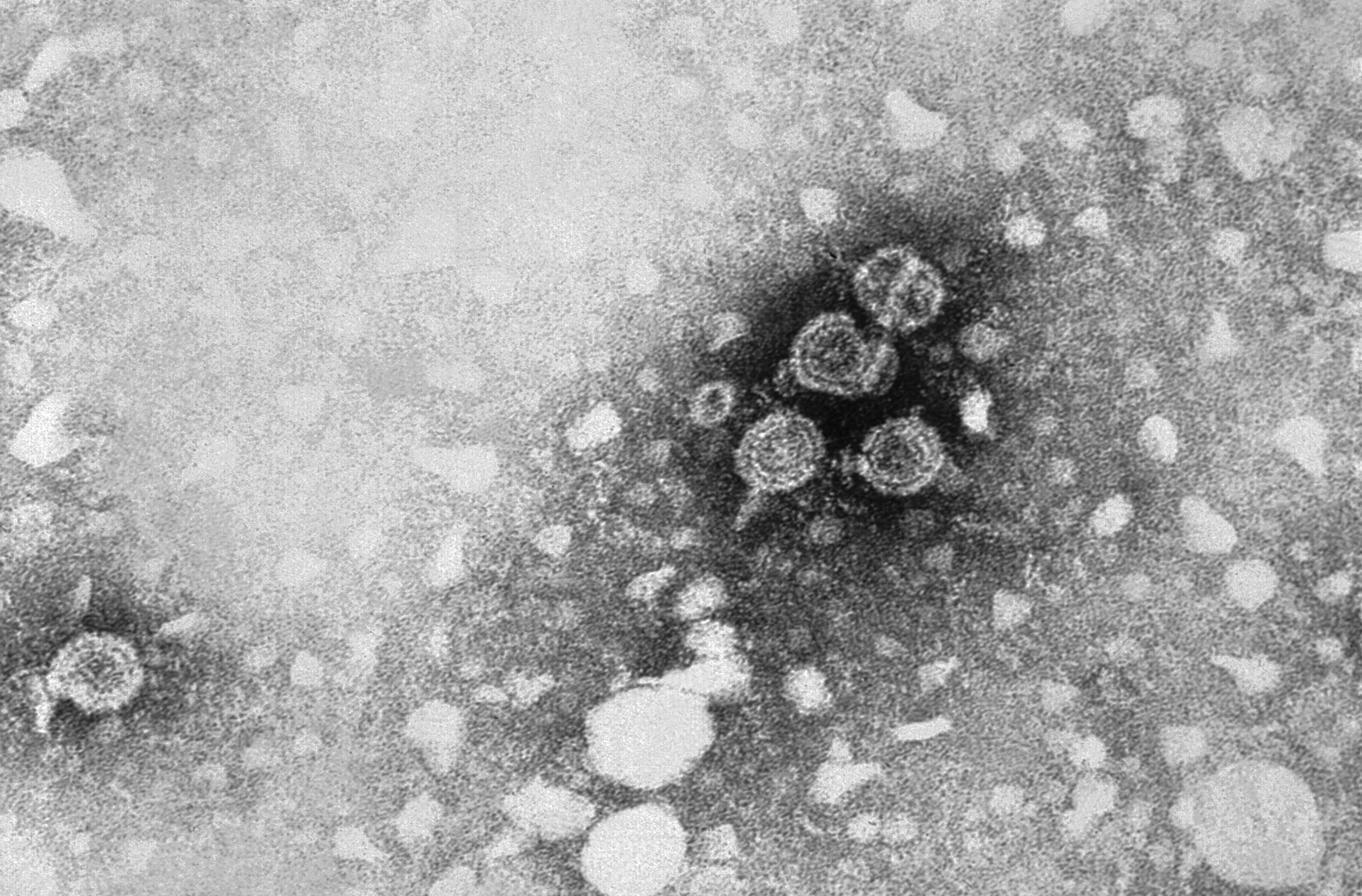 Вирус HBV