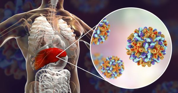 Гепатит С взят под контроль в Израиле