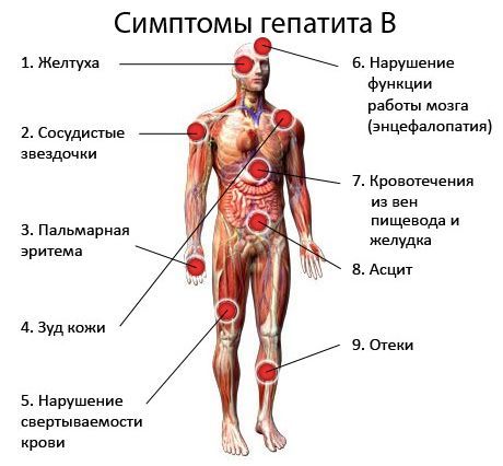 Симптомы гепатита B